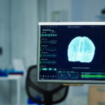 The Science Behind the TMS Treatment