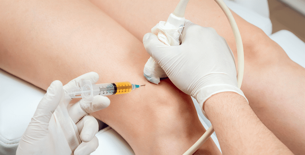 PRP Treatment For Knee Pain